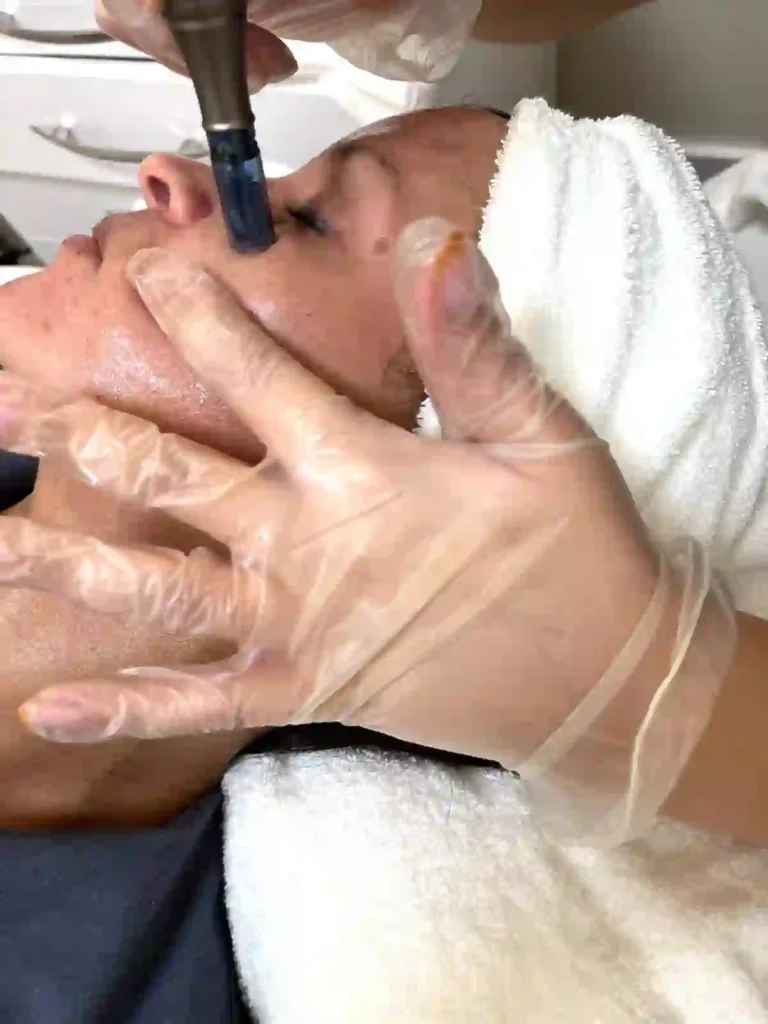 treatment img