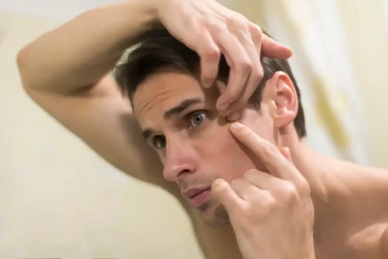 Men’s Skin Matters Too