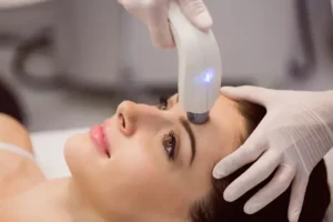 CO2 Fractional Laser Resurfacing