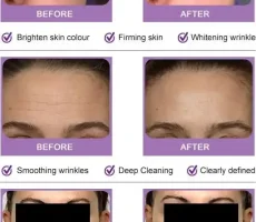 before after img