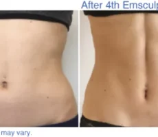 body before after img